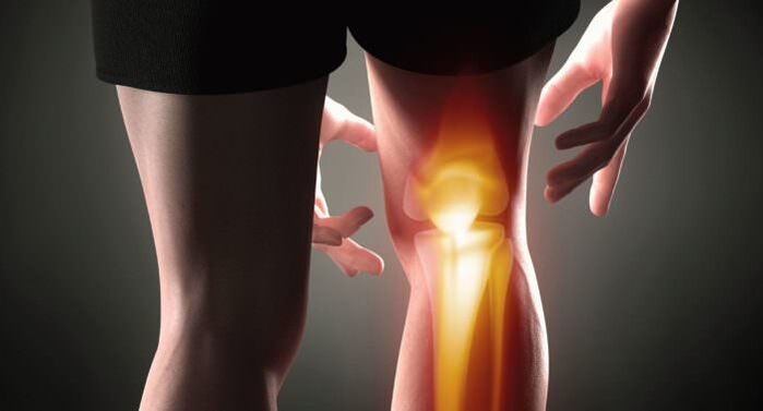 Symptoms of arthritis