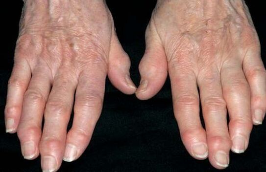 Hand