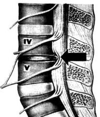X -Ray image of the Lumbar Bone