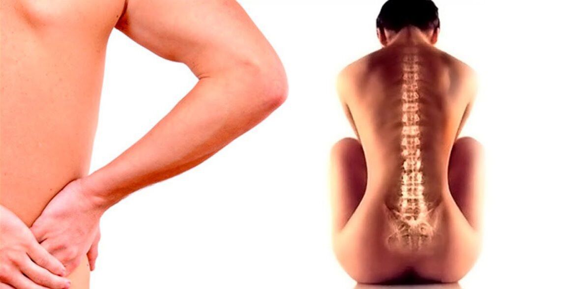 lower back pain due to osteoarthritis