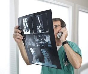 Myelography to diagnose cartilage degeneration and intervertebral herniation