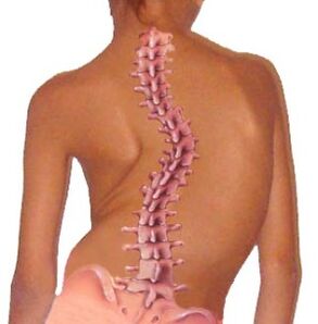 Scoliosis leads to bone and cartilage degeneration