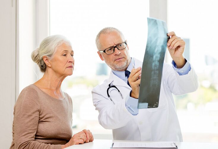 Doctors determine cervical spondylosis in patients using X-rays